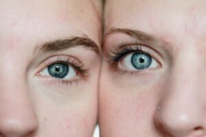 photo des yeux de deux jumelle après un test ADN